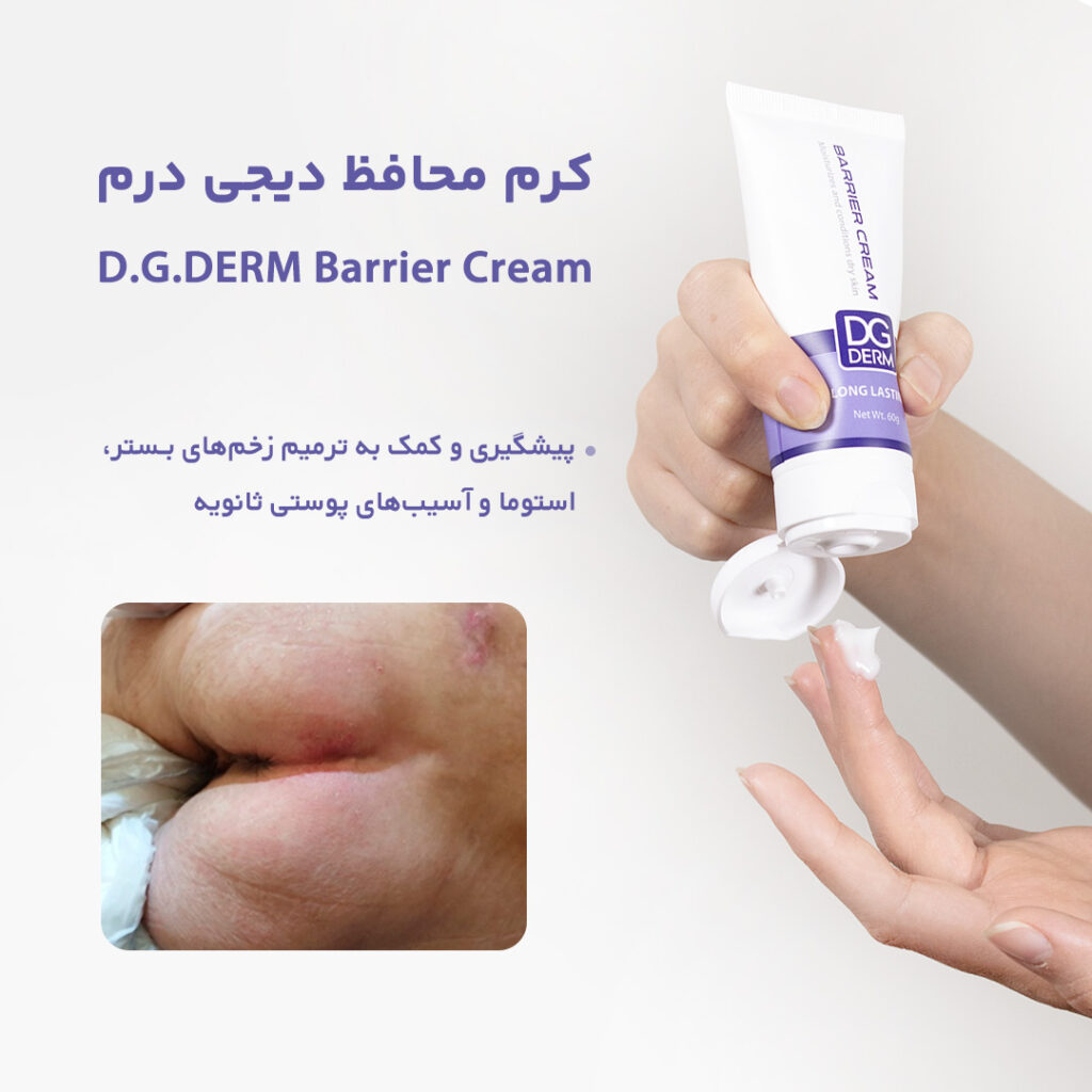 بریر کرم دی جی دنا