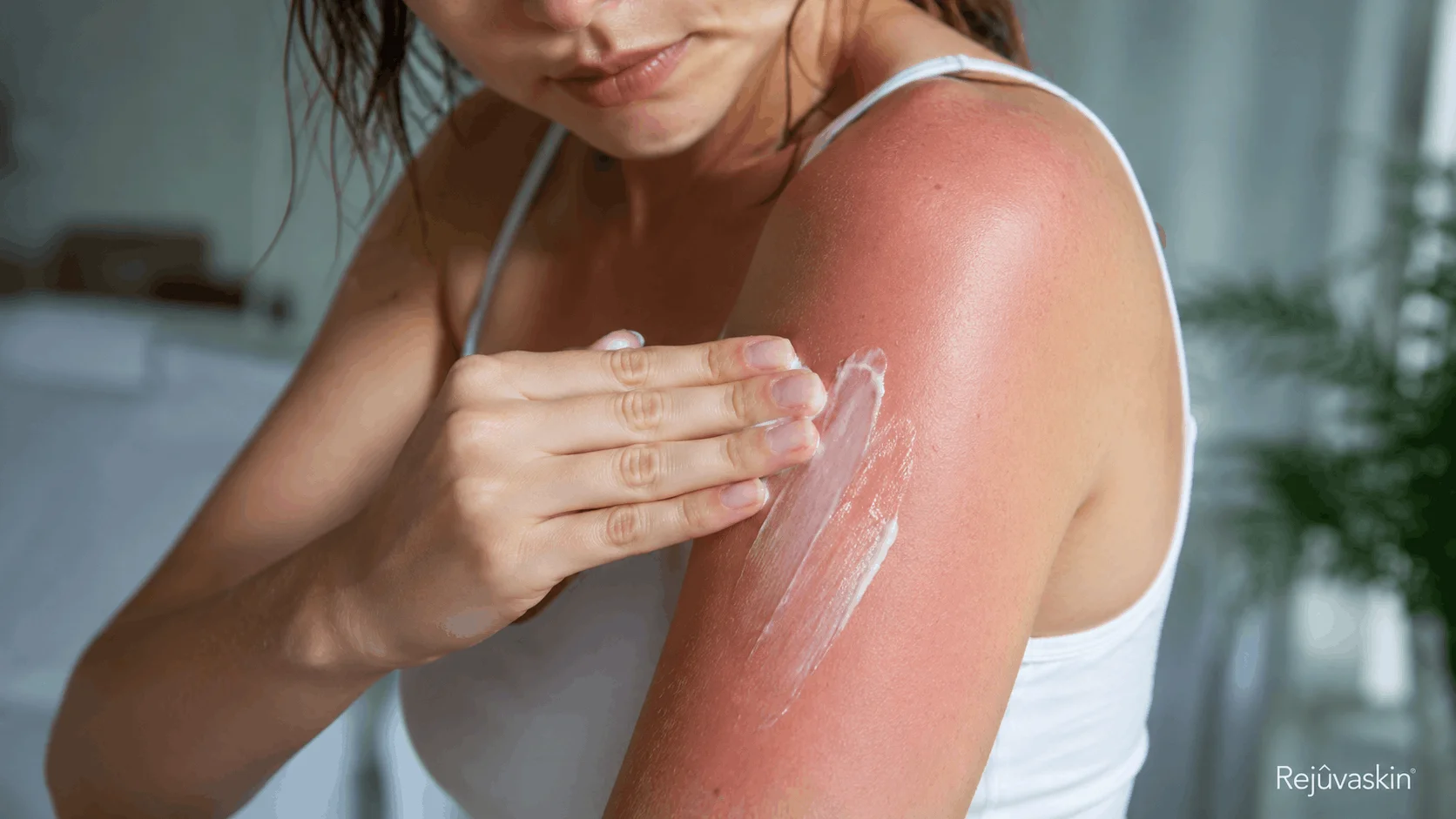 بهترین کرم برای آفتاب سوختگی صورت و بدن چیست؟